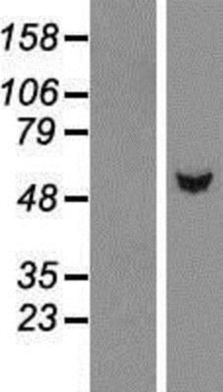 Novus Biologicals&trade;&nbsp;TBL1Y Overexpression Lysate