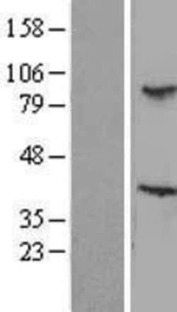 Novus Biologicals&trade;&nbsp;TBL3 Overexpression Lysate