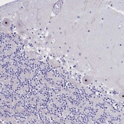 TBL3 Antibody, Novus Biologicals 0.1 mL | Buy Online | Novus Biologicals | Fisher Scientific