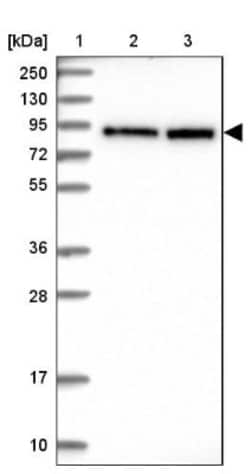 TBL3 Antibody, Novus Biologicals 0.1 mL | Buy Online | Novus Biologicals | Fisher Scientific