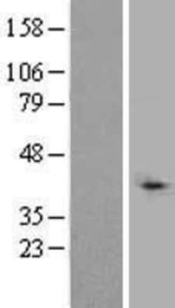 Novus Biologicals™ TBLR1 Overexpression Lysate