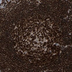 TBLR1 Antibody, Novus Biologicals 25 &mu;L; Unlabeled:Antibodies, Polyclonal