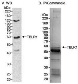 TBLR1 Antibody, Novus Biologicals 0.1mL; Unlabeled:Antibodies, Polyclonal