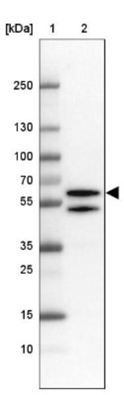 TBLR1 Antibody, Novus Biologicals 25 &mu;L; Unlabeled:Antibodies, Polyclonal