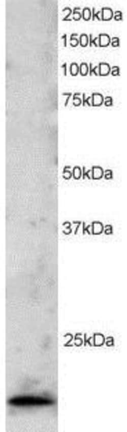 TBP like protein TLP Antibody, Novus Biologicals 0.1mg; Unlabeled:Antibodies,