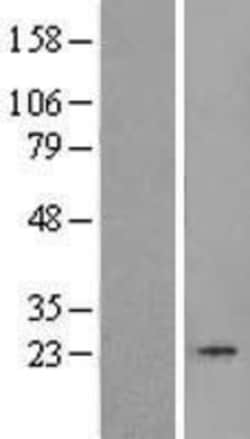 Novus Biologicals™ TBP like protein TLP Overexpression Lysate