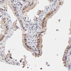 Tbp7 Antibody, Novus Biologicals 0.1mL; Unlabeled:Antibodies, Polyclonal