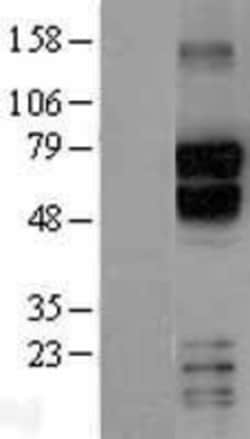 Novus Biologicals&trade;&nbsp;TBR1 Overexpression Lysate