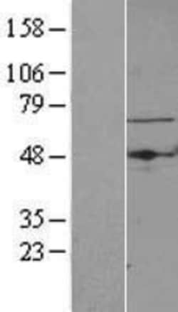 Novus Biologicals™ TBRG4 Overexpression Lysate