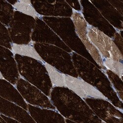 TBRG4 Antibody, Novus Biologicals:Antibodies:Primary Antibodies