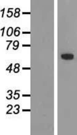 Novus Biologicals&trade;&nbsp;TBX18 Overexpression Lysate
