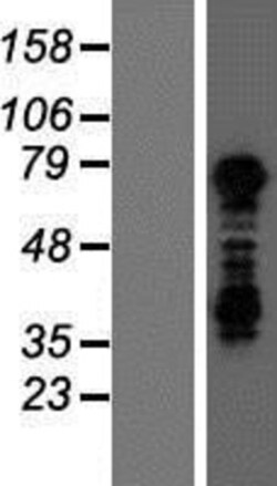 Novus Biologicals&trade;&nbsp;TBX3 Overexpression Lysate