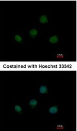 TBX5 Antibody, Novus Biologicals 0.1mL; Unlabeled:Antibodies, Polyclonal