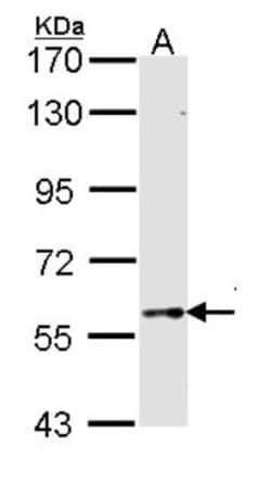 TBX5 Antibody, Novus Biologicals 0.1mL; Unlabeled:Antibodies, Polyclonal