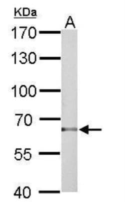 TBX5 Antibody, Novus Biologicals 0.1mL; Unlabeled:Antibodies, Polyclonal