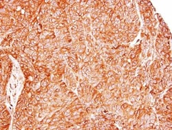 TC21/R-Ras2 Antibody, Novus Biologicals 0.1mL; Unlabeled:Antibodies, Polyclonal