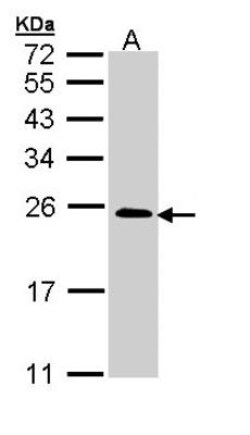 TC21/R-Ras2 Antibody, Novus Biologicals 0.1mL; Unlabeled:Antibodies, Polyclonal