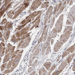 TCAP Antibody, Novus Biologicals 0.1mL; Unlabeled:Antibodies, Polyclonal