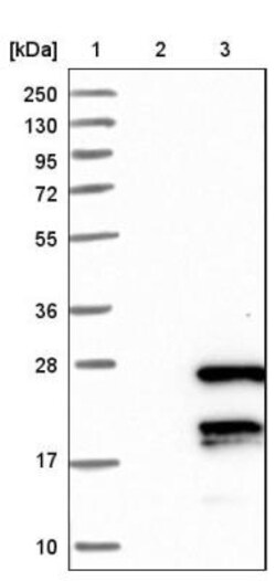 TCAP Antibody, Novus Biologicals 0.1mL; Unlabeled:Antibodies, Polyclonal