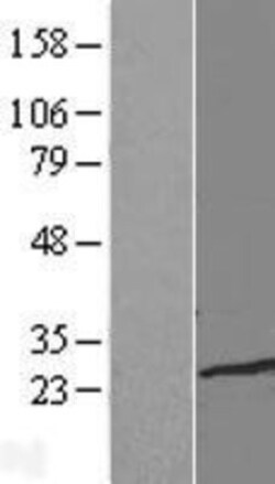 Novus Biologicals&trade;&nbsp;TCEAL1 Overexpression Lysate