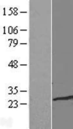 Novus Biologicals&trade;&nbsp;TCEAL1 Overexpression Lysate