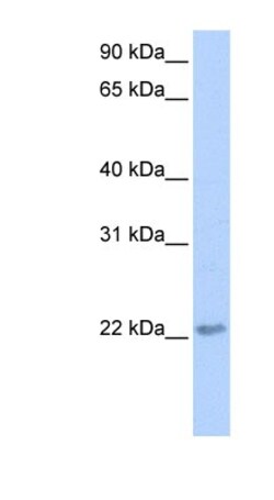 TCEAL2 Antibody, Novus Biologicals 100 &mu;L | Buy Online | Novus Biologicals | Fisher Scientific