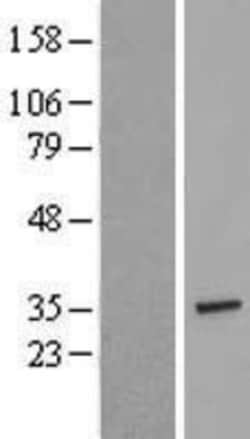 Novus Biologicals&trade;&nbsp;TCEAL2 Overexpression Lysate