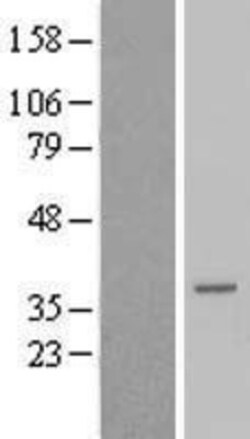 Novus Biologicals&trade;&nbsp;TCEAL6 Overexpression Lysate