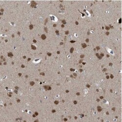 TCEAL7 Antibody, Novus Biologicals 25 &mu;L | Buy Online | Novus Biologicals | Fisher Scientific