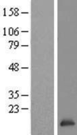 Novus Biologicals&trade;&nbsp;TCEB2 Overexpression Lysate