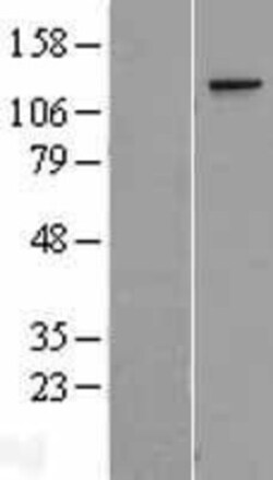 Novus Biologicals&trade;&nbsp;TCERG1 Overexpression Lysate
