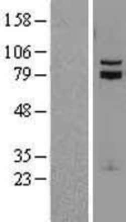 Novus Biologicals™ TCF-12/HTF4 Overexpression Lysate