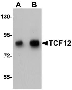 TCF-12/HTF4 Antibody - BSA Free, Novus Biologicals 0.025 mg | Buy Online | Novus Biologicals | Fisher Scientific