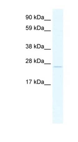 TCF23 Antibody, Novus Biologicals:Antibodies:Primary Antibodies