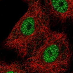 TCF-2/HNF-1 beta Antibody (CL0374), Novus Biologicals:Antibodies:Primary