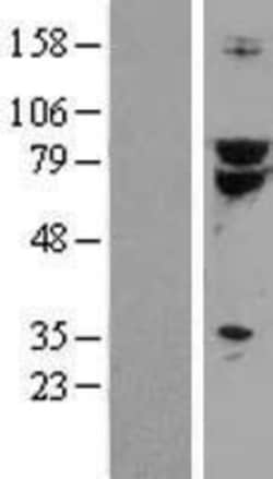 Novus Biologicals™ TCF-3/E2A Overexpression Lysate