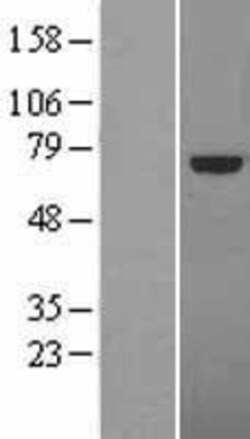Novus Biologicals™ TCF4 Overexpression Lysate