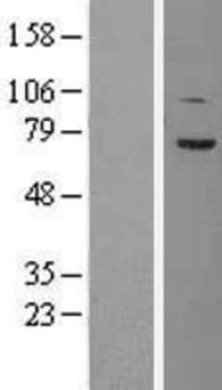Novus Biologicals&trade;&nbsp;TCF4 Overexpression Lysate