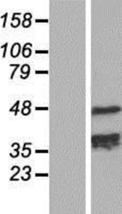 Novus Biologicals&trade;&nbsp;TCHP Overexpression Lysate