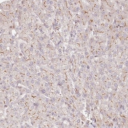 TCHP Antibody, Novus Biologicals 0.1mL; Unlabeled:Antibodies, Polyclonal
