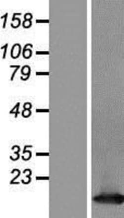 Novus Biologicals&trade;&nbsp;TCL1A Overexpression Lysate