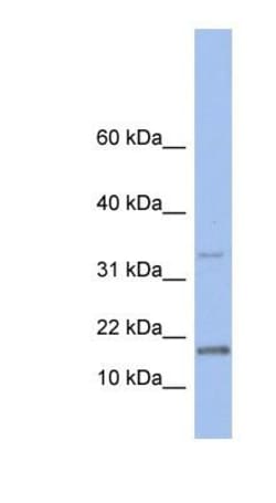 TCL1A Antibody, Novus Biologicals 100&mu;L; Unlabeled:Antibodies, Polyclonal