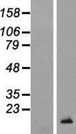 Novus Biologicals&trade;&nbsp;TCL1B Overexpression Lysate