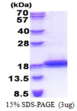 Novus Biologicals&trade;&nbsp;Recombinant Human TCL1B His Protein