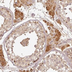 TCL1B Antibody, Novus Biologicals 0.1mL; Unlabeled:Antibodies, Polyclonal