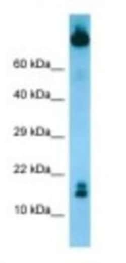 TCL1B Antibody, Novus Biologicals:Antibodies:Primary Antibodies