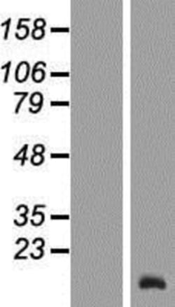 Novus Biologicals™ TCL6 Overexpression Lysate