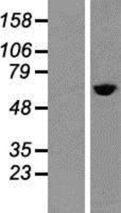 Novus Biologicals™ TCP1 alpha Overexpression Lysate