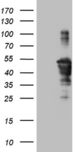 TCP10 Antibody (OTI2C2), Novus Biologicals 0.1mL; Unlabeled:Antibodies,