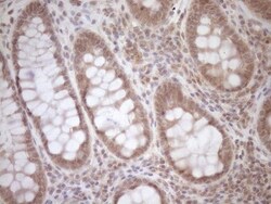 TCP10 Antibody (OTI2C2), Novus Biologicals 0.1mL; Unlabeled:Antibodies,
